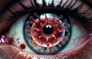 Bleeding Eye Virus: ब्लीडिंग आई वायरस